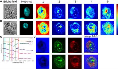 Coherent anti-Stokes Raman scattering cell imaging and segmentation with unsupervised data analysis